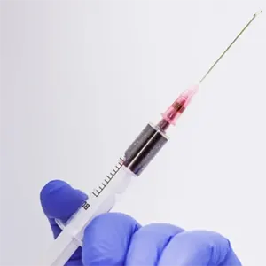 Αιματολογικός έλεγχος